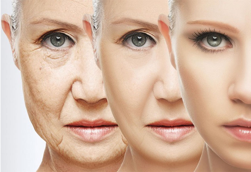 5 نوع چروک صورت و روش درمان آنها