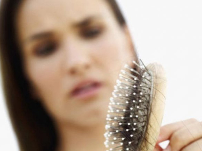چرب شدن موها - سلامت مو