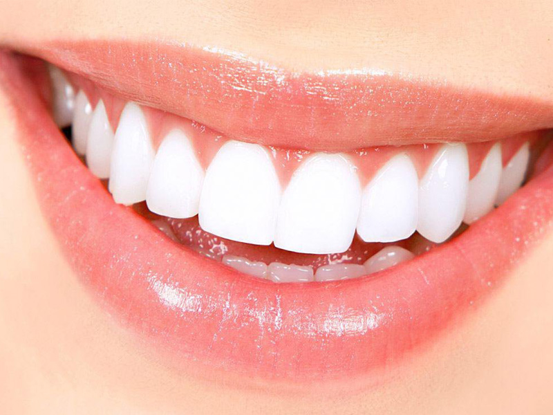 ایمپلنت دندان چیست؟ چه فواید و عوارضی دارد؟
