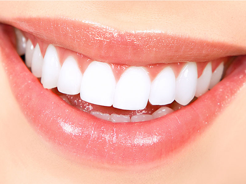 روش های سفید کردن دندان را بشناسید